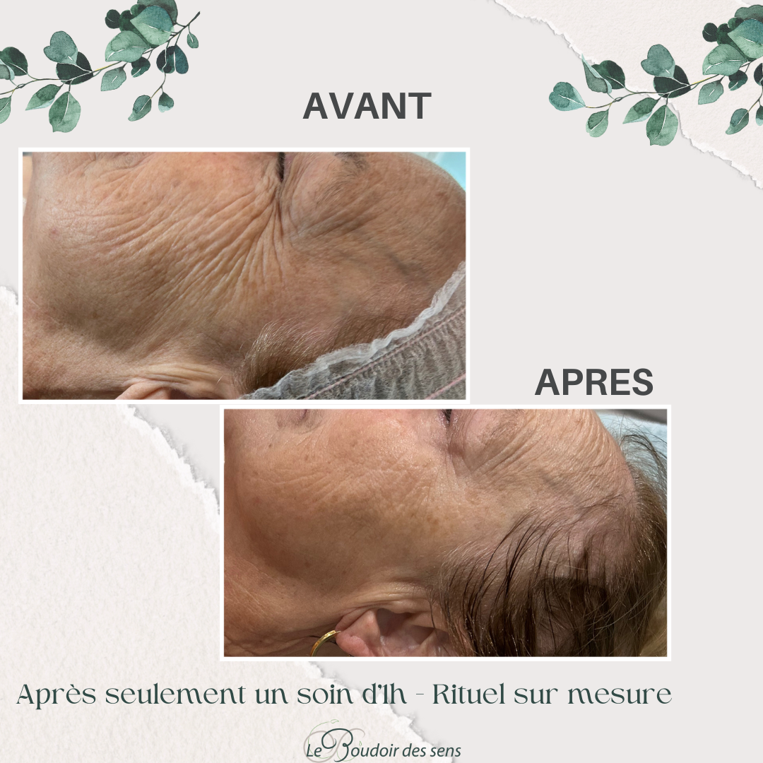 avant après 1 soin visage rituel sur mesure 1