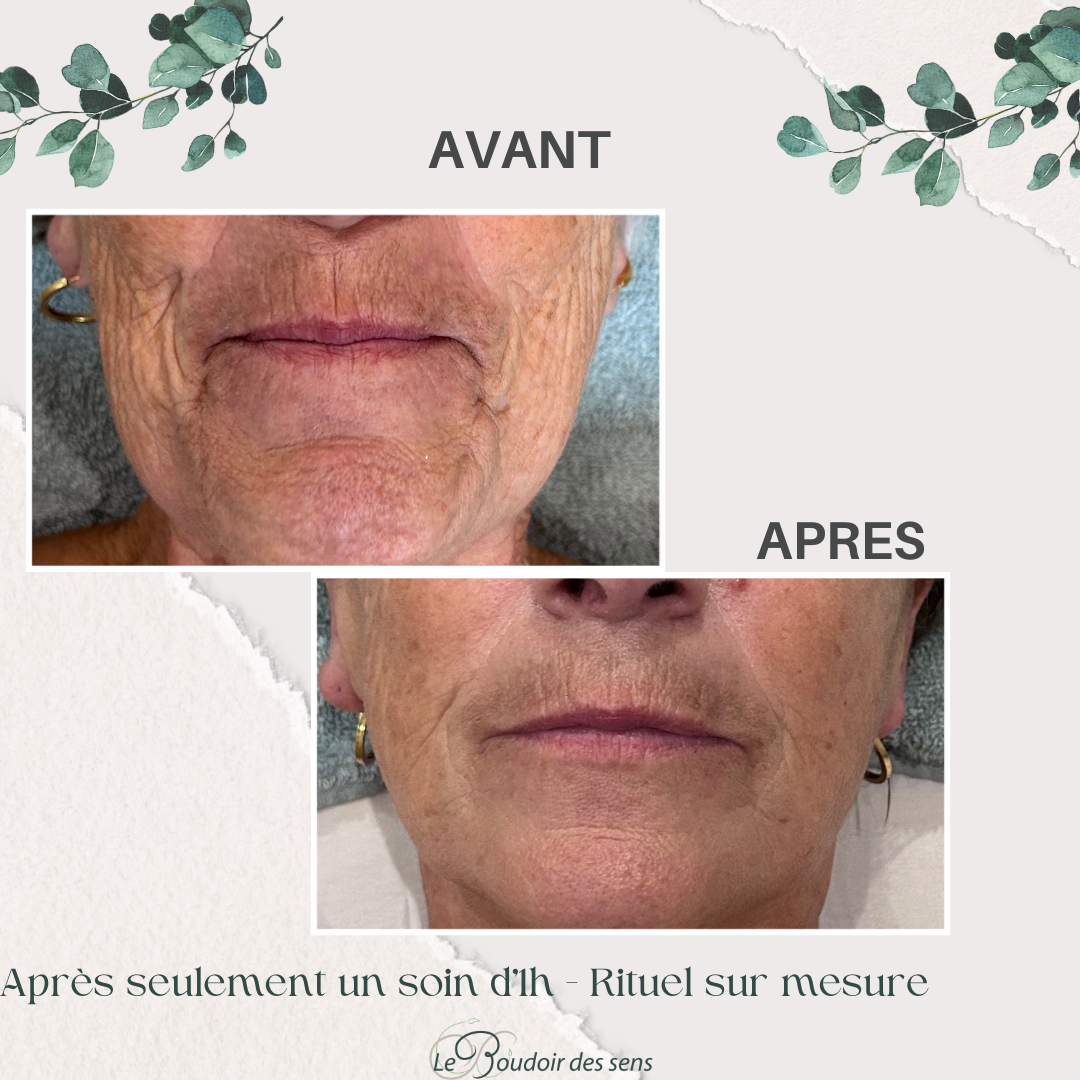 avant après 1 soin visage rituel sur mesure 2