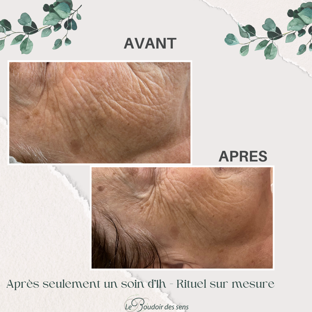 avant après 1 soin visage rituel sur mesure