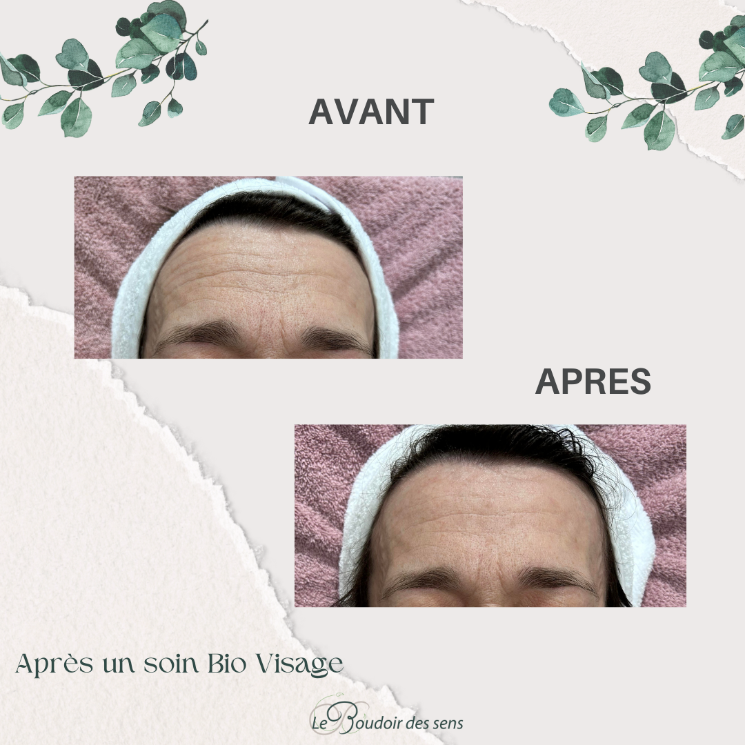avant après bio visage 1