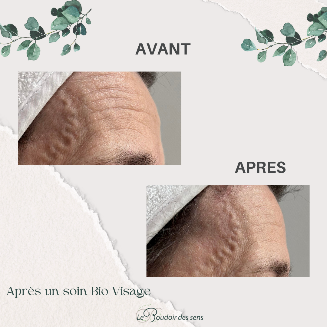 avant après bio visage 2